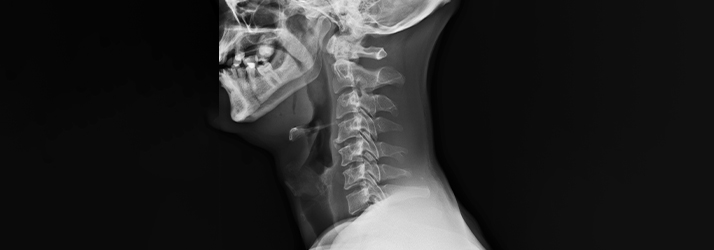 Chiropractic Molalla OR Digital X-Rays